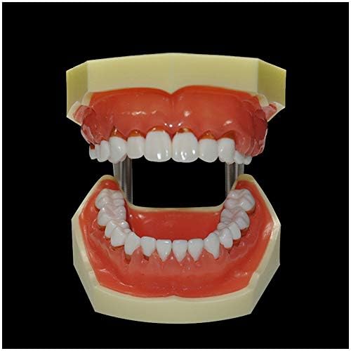 Модел на зъбите със заболявания на пародонта KH66ZKY - Модел стоматологично Типодонта - Рецесия на венците, Периодонтальная стаж, Модел